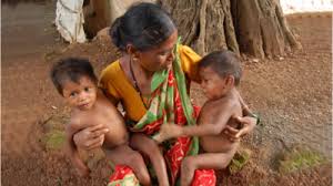 Gujarat's health policy needs a spotlight on malnutrition for steering growth further